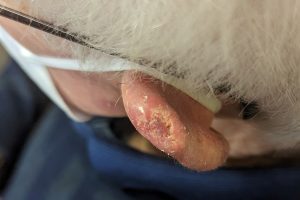 clinical-image-ear-lesion-22-May-2023