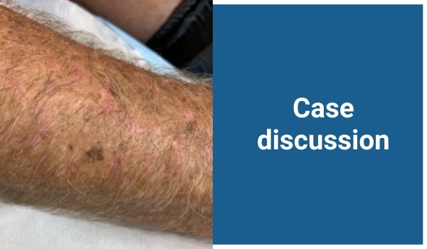 case discussion