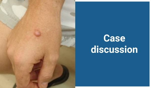 case discussion