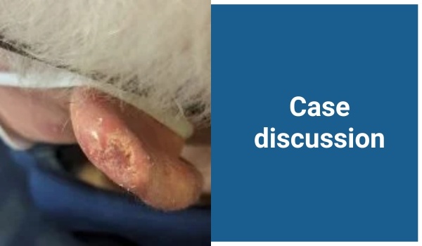 case discussion