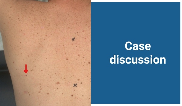 case discussion