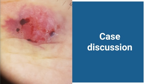 case discussion