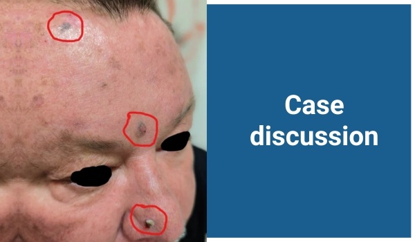 case discussion