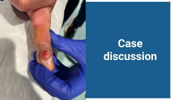 case discussion
