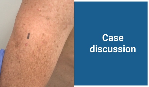 case discussion