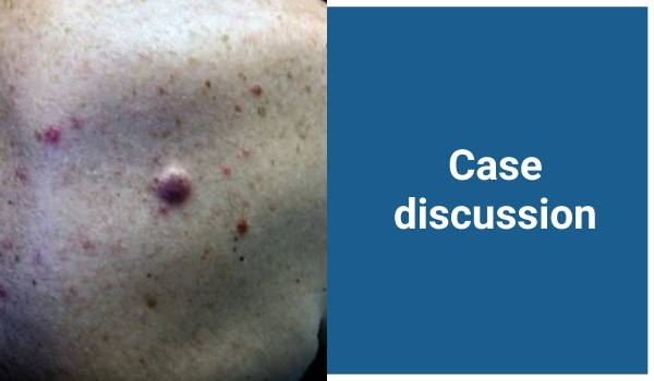 case discussion