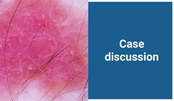 case discussion
