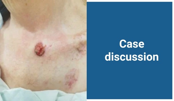 case discussion