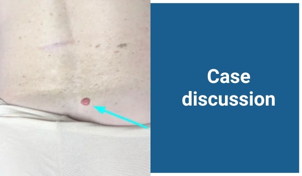 case discussion