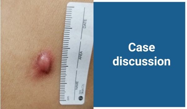 case discussion