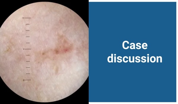 case discussion