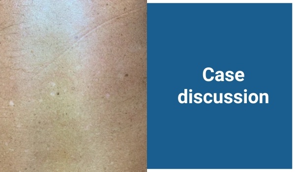 case discussion