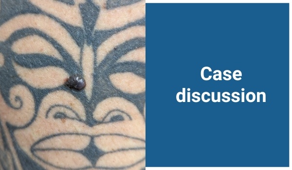 case discussion