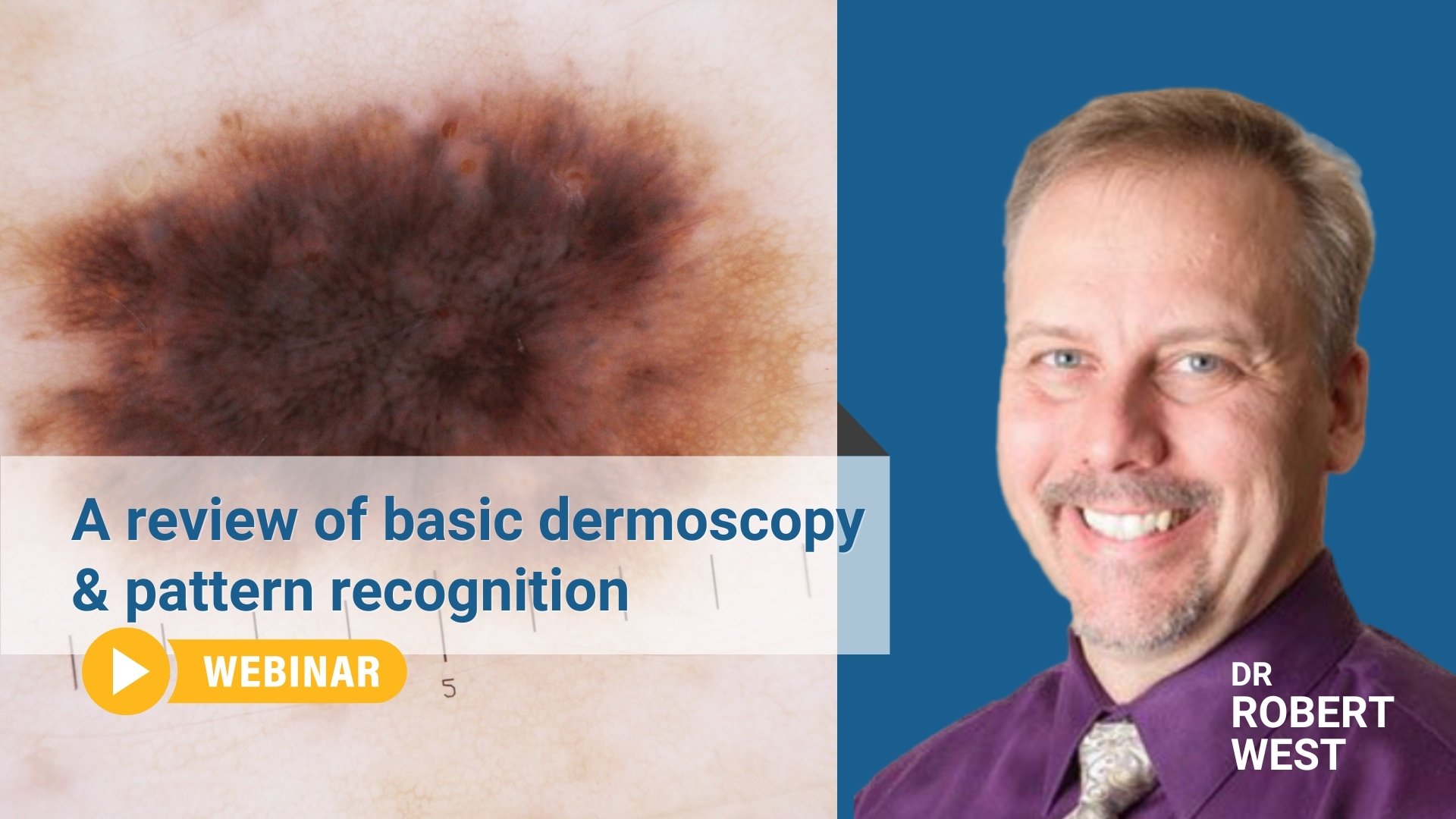 basic dermoscopy review