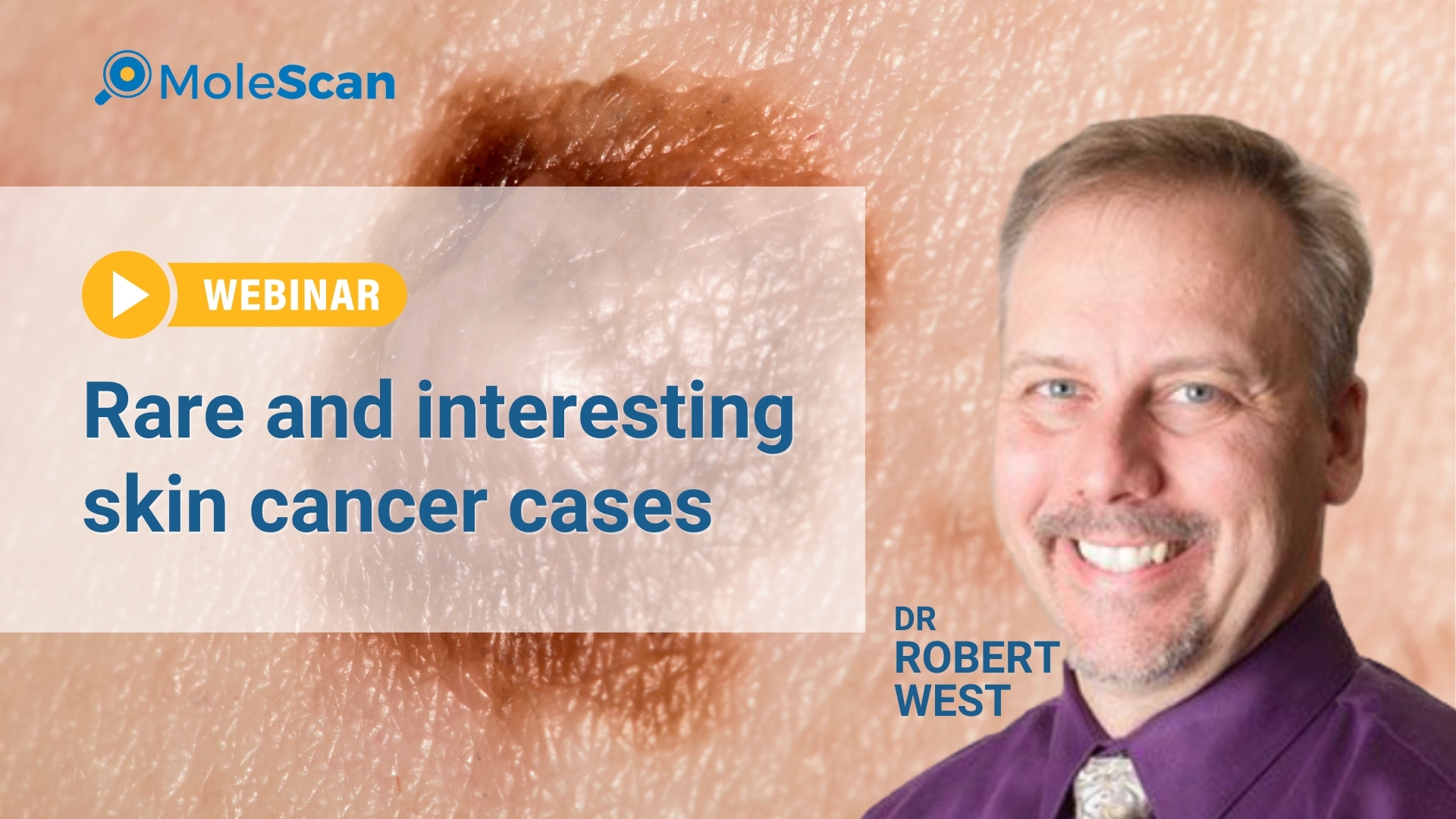 rare skin cancer cases