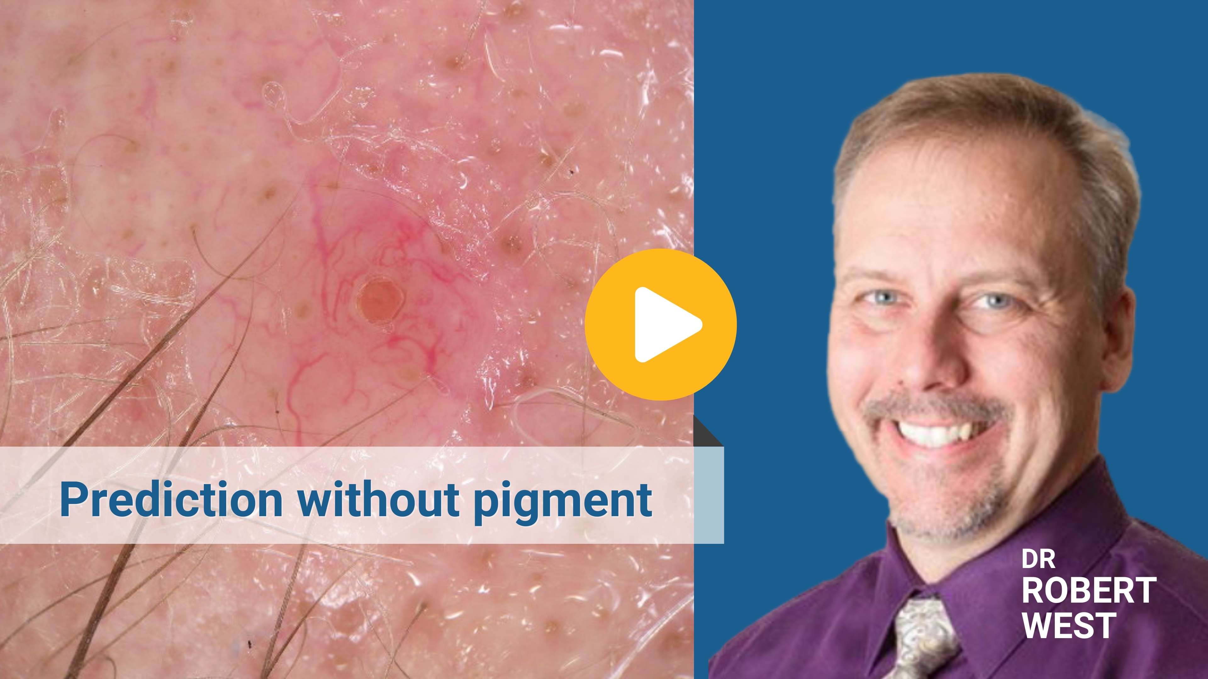 prediction without pigment